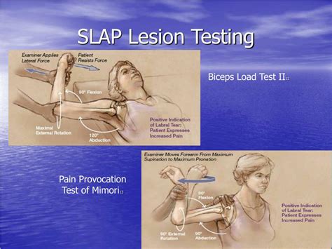 labrum tear tests|test for slap tear shoulder.